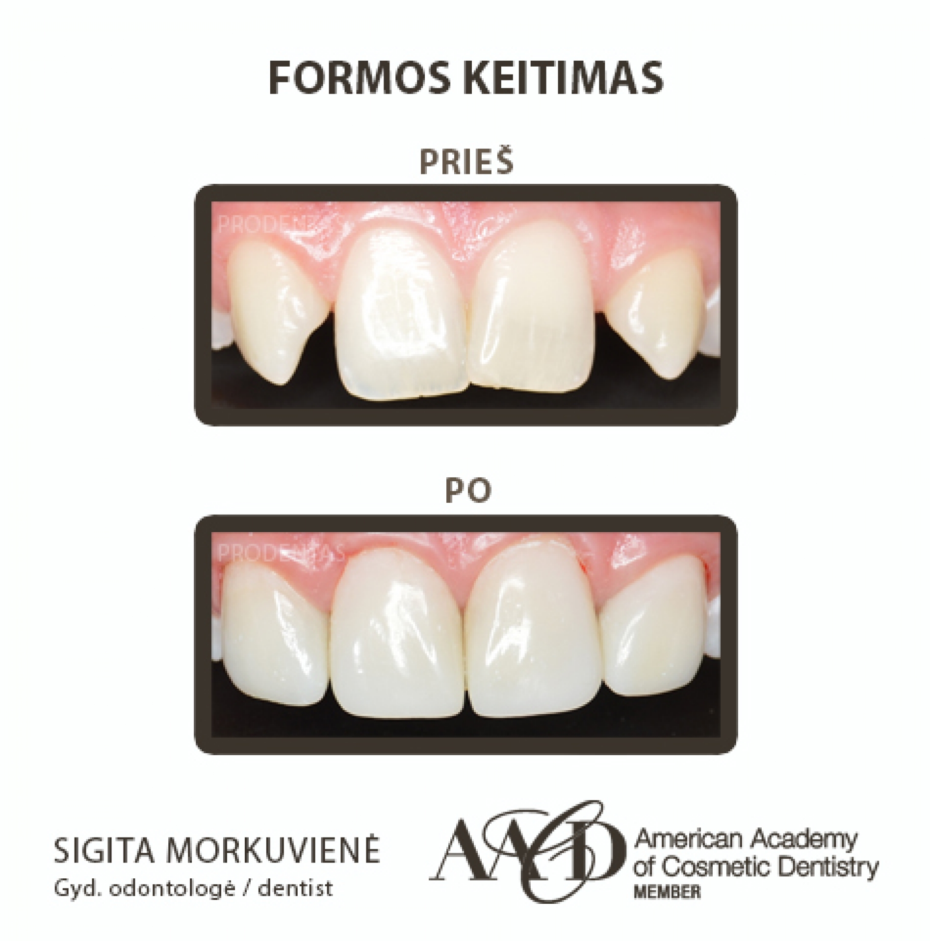 Odontologijos, stomatologijos klinikos Dantų balinimas, burnos higiena, estetinis plombavimas