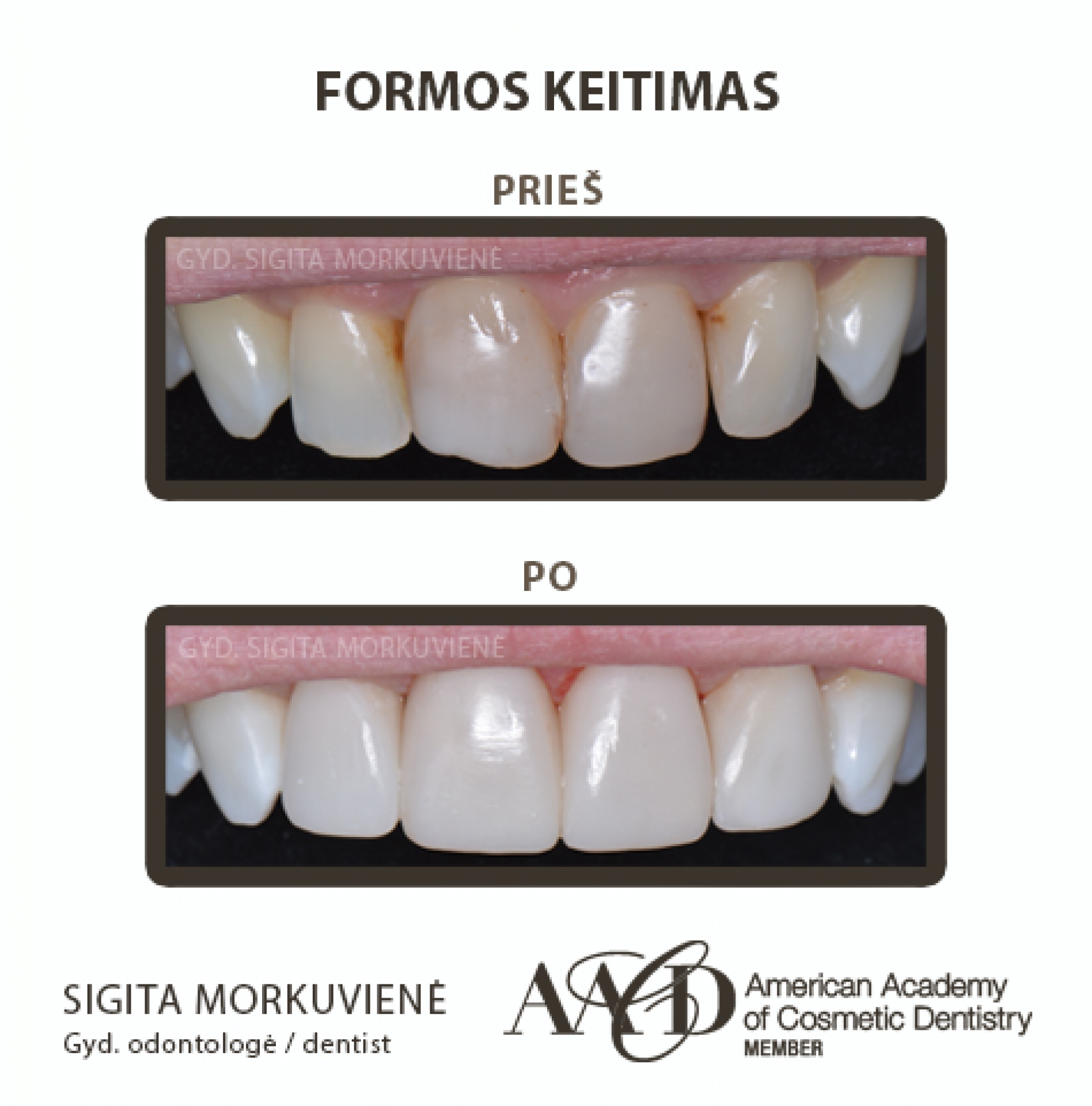 Odontologijos, stomatologijos klinikos Dantų balinimas, burnos higiena, estetinis plombavimas